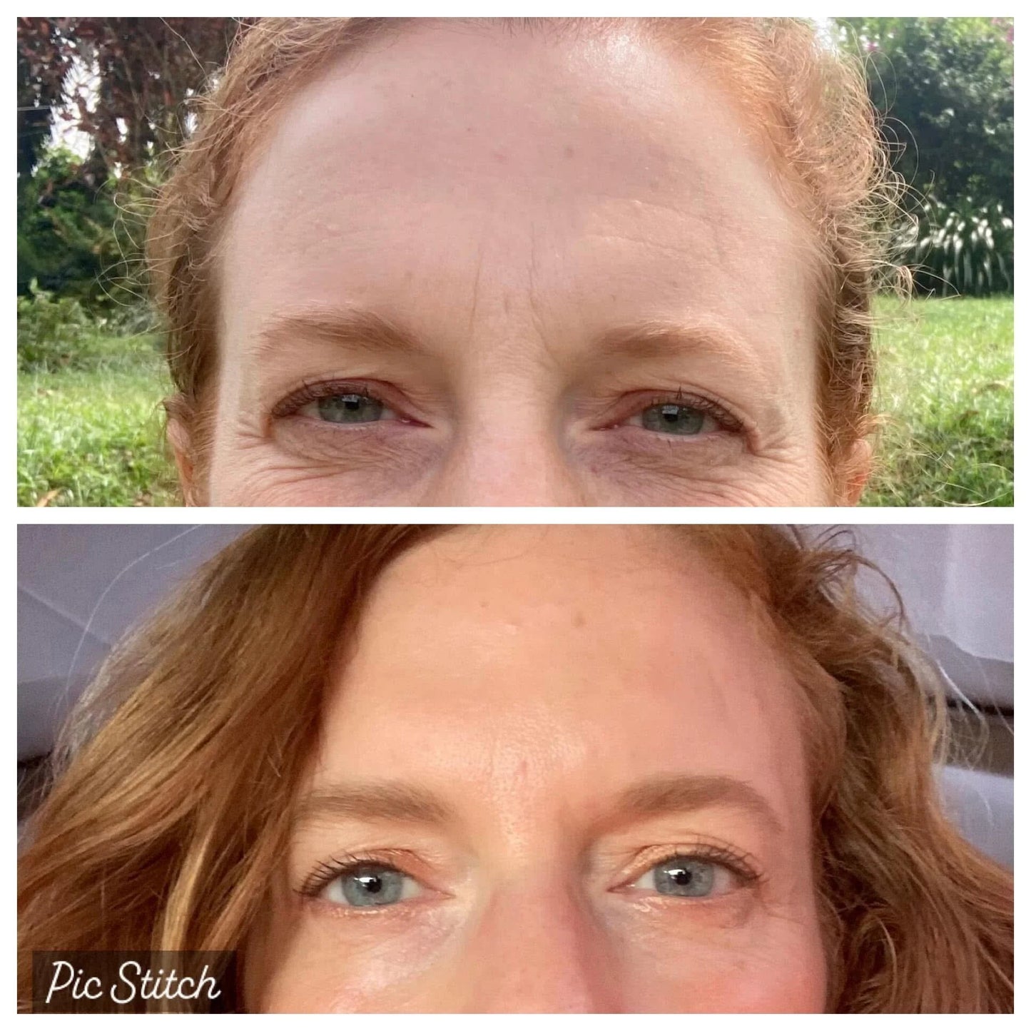 PDRN Rejuvenating Under Eye Patches