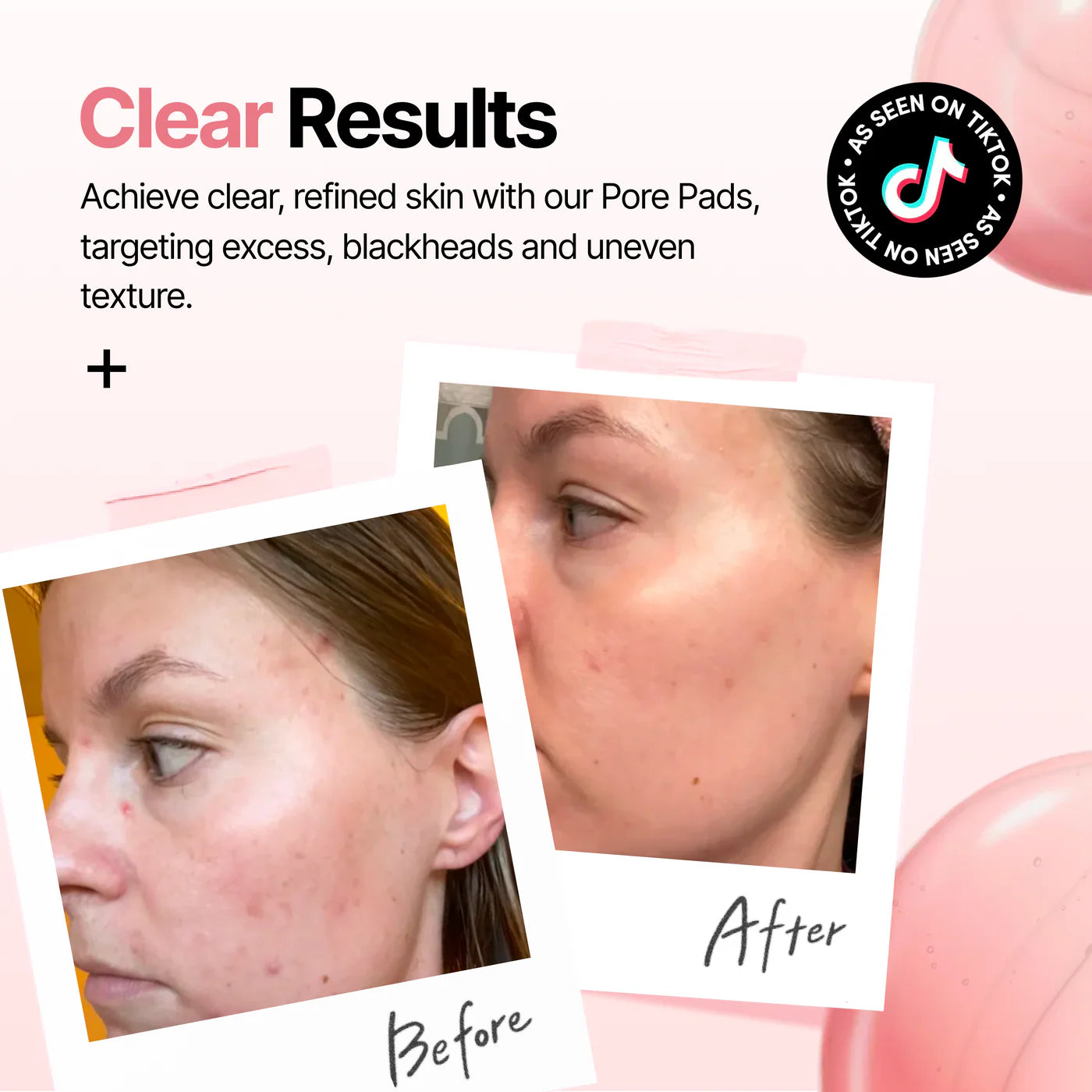 PDRN Zero Pore Pads