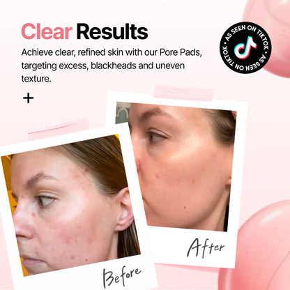 PDRN Zero Pore Pads
